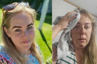 Huragan w Tomrefjord: Angelika trafiona przez blachę w czasie wichury