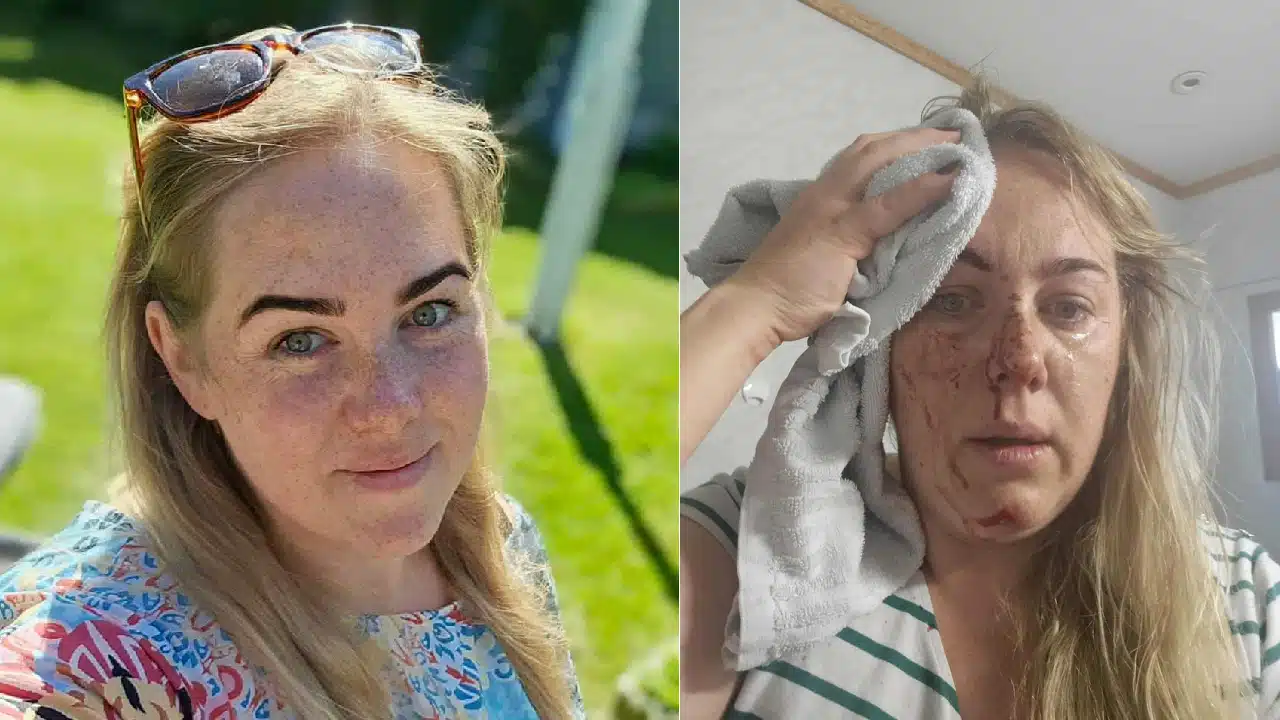 Huragan w Tomrefjord: Angelika trafiona przez blachę w czasie wichury