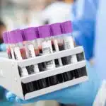 Rząd ogranicza finansowanie: koniec publicznych dopłat do badań zlecanych przez prywatnych lekarzy