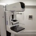 Sztuczna inteligencja nie odciąży lekarzy w mammografii? Technologia kontra rzeczywistość - nowe dane z Norwegii